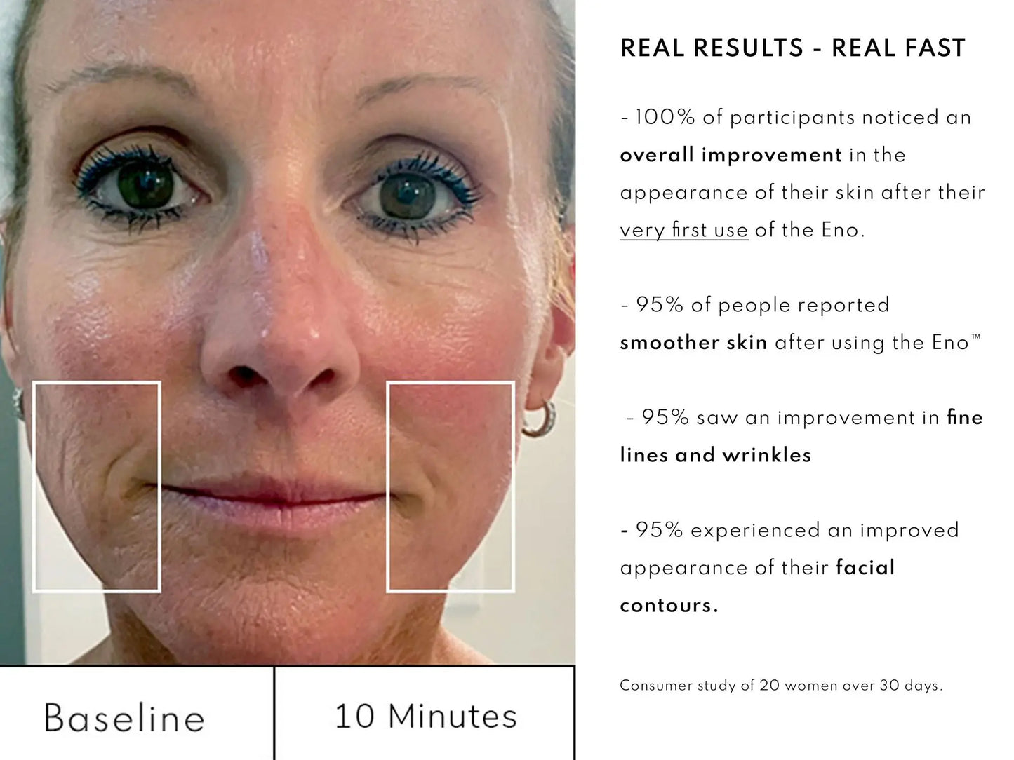 Eno Sensitive Skin Facial Kit. A complete skincare solution for sensitive skin that includes the Patented Eno Facial Device Doba